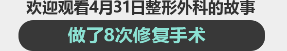 4월31일 성형외과 수술동영상을 확인하세요! / 영상으로 보는 수술동영상