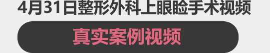 4월31일 성형외과 수술동영상을 확인하세요! / 영상으로 보는 수술동영상